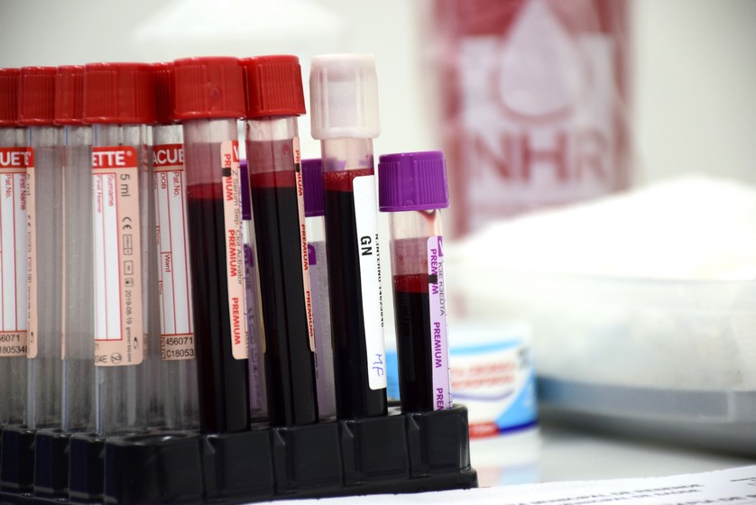 Hemonúcleo de Resende esclarece dúvidas sobre cuidados com o coronavírus e reforça doações de sangue
